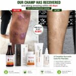 Effect Care Health Experts | Psorasis Care Combo Kit | EC CREAM PACK + RAKTA MANTRA BLOOD PURIFIER SYRUP + RAKTA MANTRA CAPSULES (60Cap) - Image 14