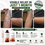 Effect Care Health Experts | Psorasis Care Combo Kit | EC CREAM PACK + RAKTA MANTRA BLOOD PURIFIER SYRUP + RAKTA MANTRA CAPSULES (60Cap) - Image 12